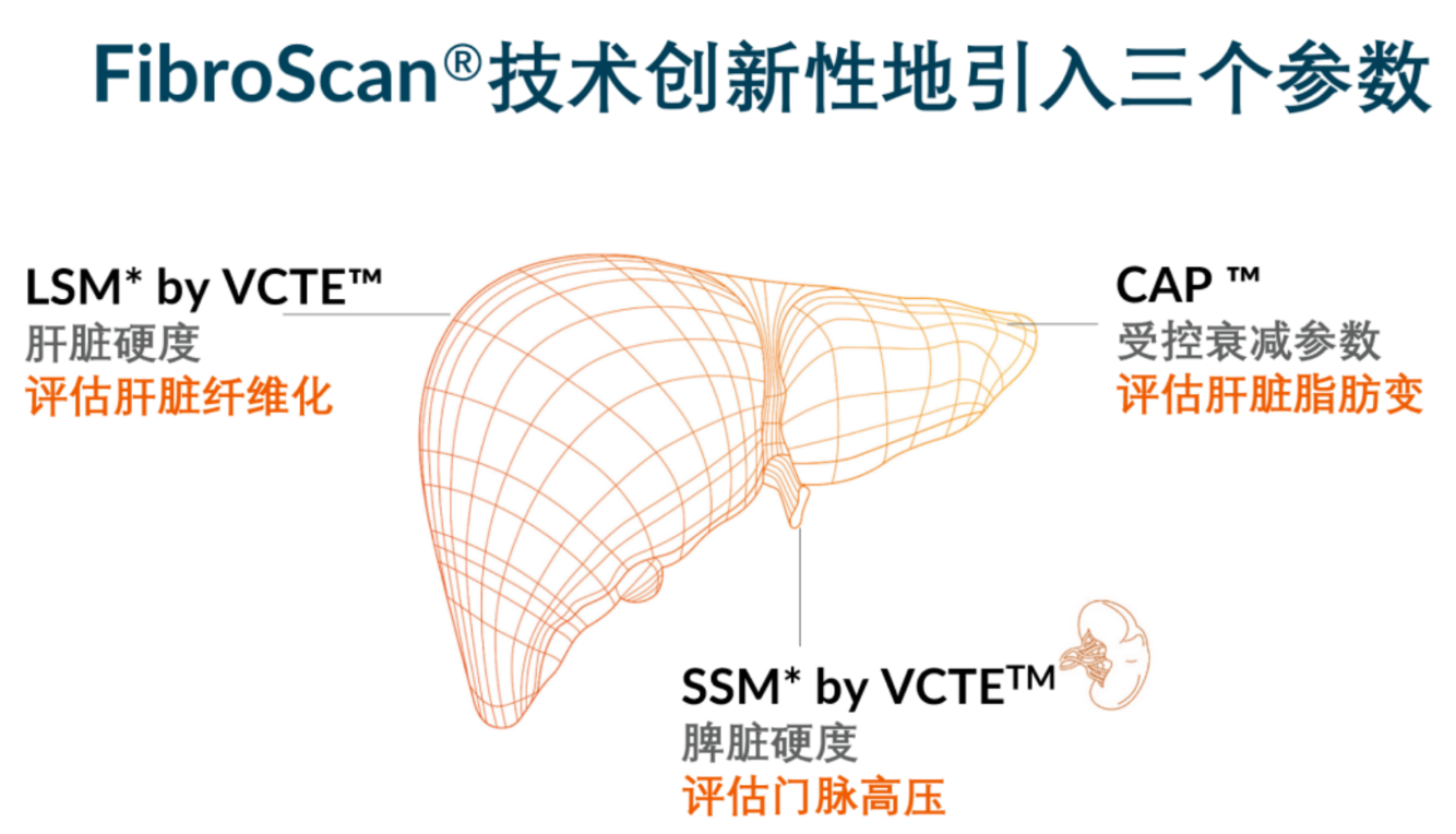 喜訊！FDA擴(kuò)大了FibroScan?在肝臟綜合管理中的應(yīng)用范圍
